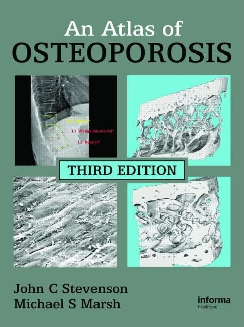 An Atlas of Osteoporosis (Encyclopedia of Visual Medicine Series)      3rd Edition