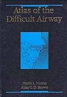 Atlas of the Difficult Airway: A Source Book 0815164254 Book Cover