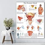Ling88 Bilder, Poster, Gemälde, Back to School Prostata Anatomische Diagramme Poster Anatomie Leinwanddruck Wandbilder Medizinische Ausbildung Büroposter Und Drucke - 50X70Cm