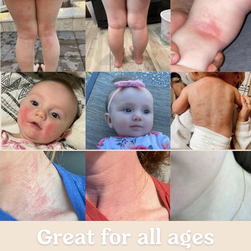 image for Roe Wellness Baby Cream & Baby Serum Power Pair Biome Barrier | For Al