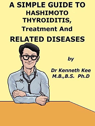 A Simple Guide To Hashimoto Thyroiditis Treatment And Related