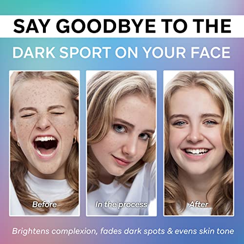 Dark Spot Remover For Face,Dark Spot Corrector Serum,Hyperpigmentation Treatment,Advanced And Natural Formula - - Removes Freckles, Sun Spots, Melasma And More, #TOP5