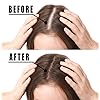 Hair-Growth-Serum-Votala-Hair-Growth-Treatment-Hair-Serum-Anti-Hair-Loss-Thinning-Balding-Repairs-Hair-Follicles-Promotes-Thicker-Stronger-Hair-And-Promotes-Hair-Regrowth Hair Growth Serum, VOTALA Hair Growth Treatment, Anti Hair Loss, Promotes Thicker, Stronger Hair, And Hair Regrowth for Men Women