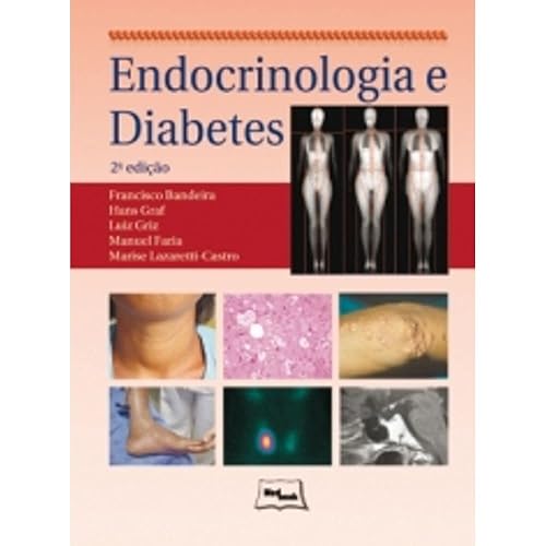 Endocrinologia e Diabetes