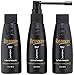 Revivogen MD Scalp Therapy 3 Month Kit Thinning Hair Solution, Natural DHT Blocker Ingredients, Experience Healthier Hair Growth for Men & Women with Hair Loss, 2 Fl oz, Pack of 3