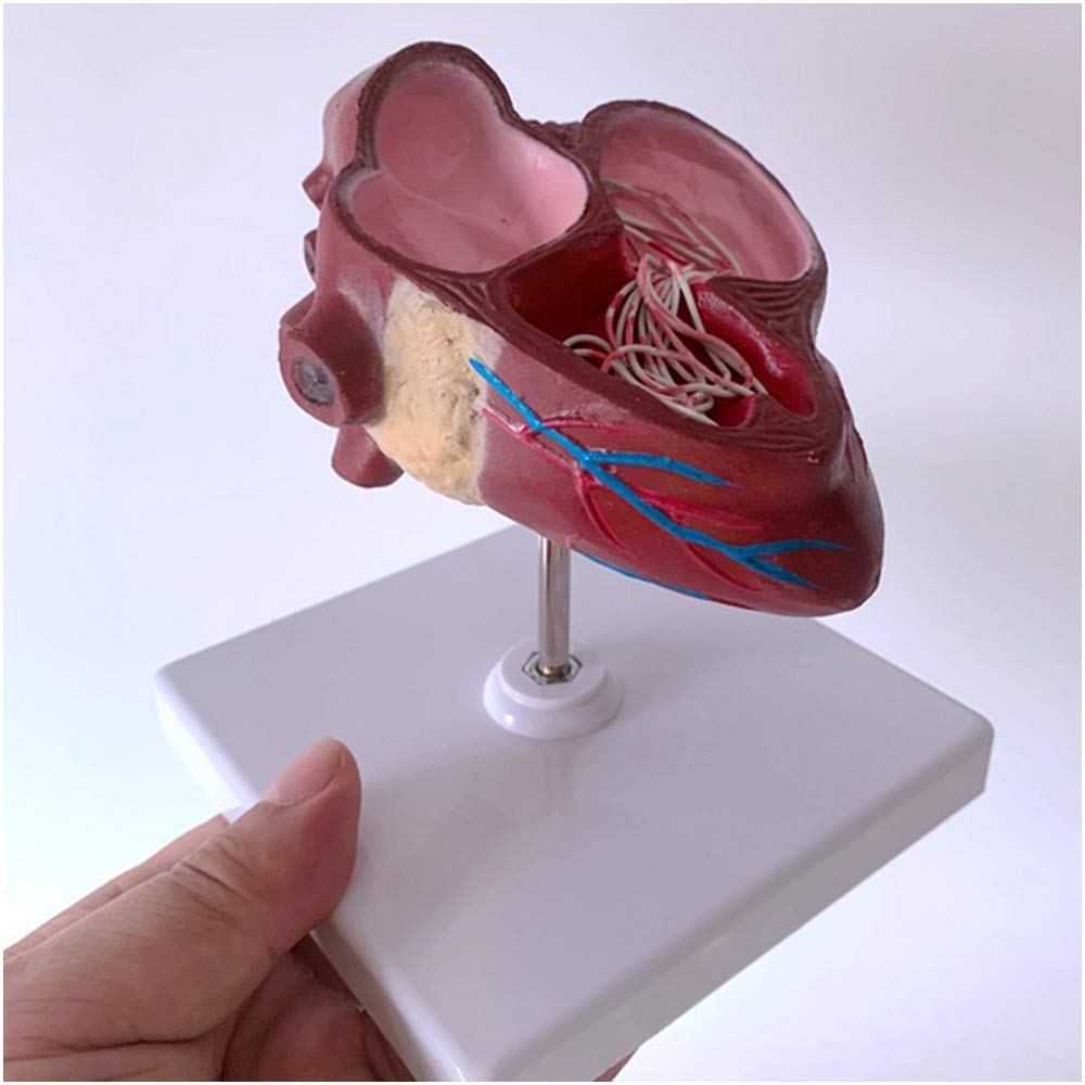 Trapano A Batteria 18V Einhell TC-CD 18-2 Li 2 Batterie 1,3 Ah - Foto 3