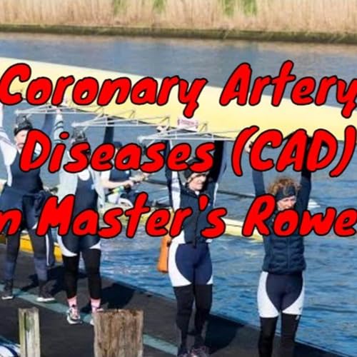 Coronary Artery Diseases CAD in Masters Rowers