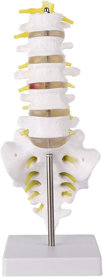 Lumbar Spine Anatomy Model,12.6" Scientific Mini Vertebral Column Model Details Vertebrae,Sacrum,Body Five Sections Lumbar vertebrae,Soft Disc,for Medical Rehabilitation Training Didactic