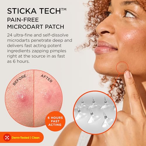 ZitSticka Killa Microdart Pimple Patch (4-Count) — view 2