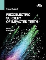 Piezoelectric surgery of impacted teeth 8821453081 Book Cover