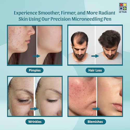 Image of Microneedling Pen Professional Derma Pen with Adjustable Needle Depth, 3 Speed Rechargeable Micro Needling Device for Acne Scars, Wrinkles, Hair Growth Skin Repair, & More
