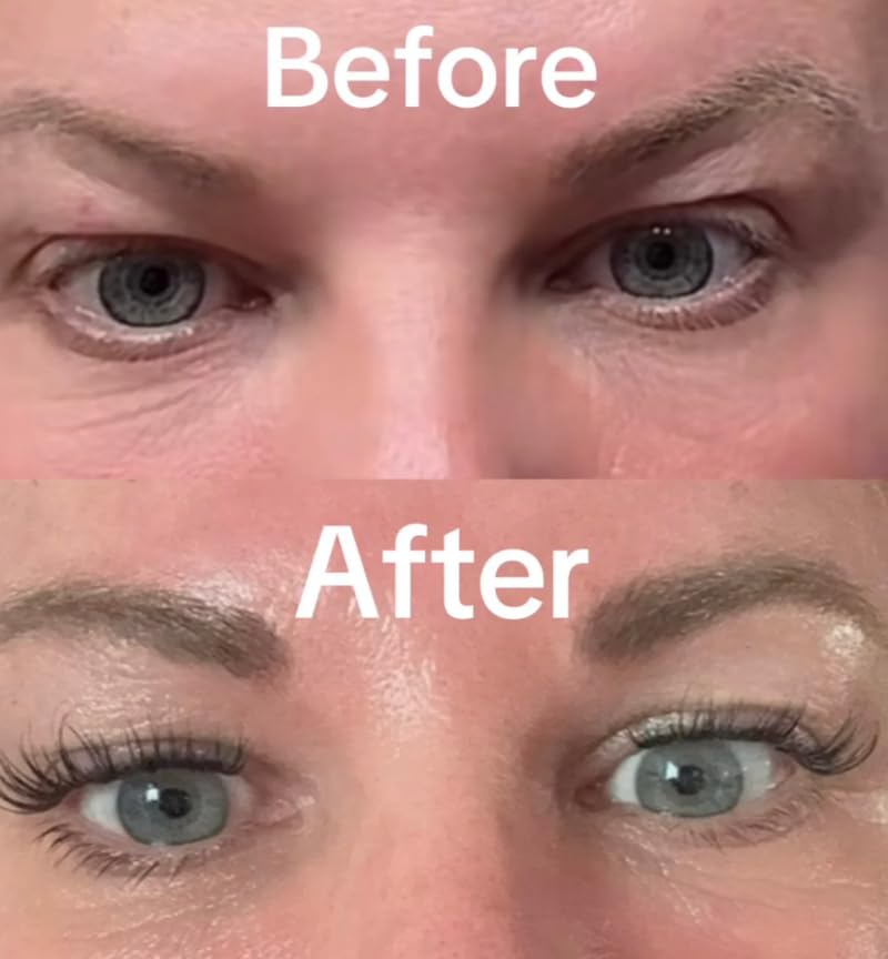 Intoxicated Cosmetics Snake Eyes Eye Serum 15 ml - Bakuchiol Under Eye Solution for Women and Men - Lift | Tighten | Brighten - Image 4