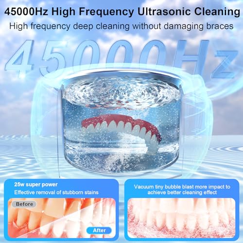 Nalax Limpador de retentor ultrassônico, limpador ultrassônico profissional 45000Hz para dentaduras,