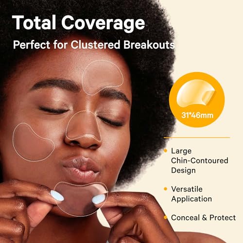Image of Sosky Chin Pimple Patches Hydrocolloid Acne Patches for Breakouts Large Spot Control Covers for Face Chin & Body Vegan Cruelty Free (10 Count)