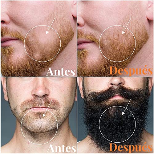 Piel Sensible, Home Imagen adicional