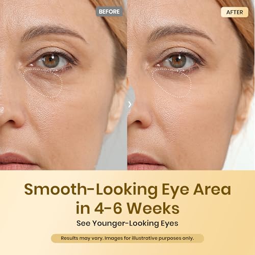 Beetles Caffeine Eye Cream with Retinol, Blur & Glow Under Eye Cream