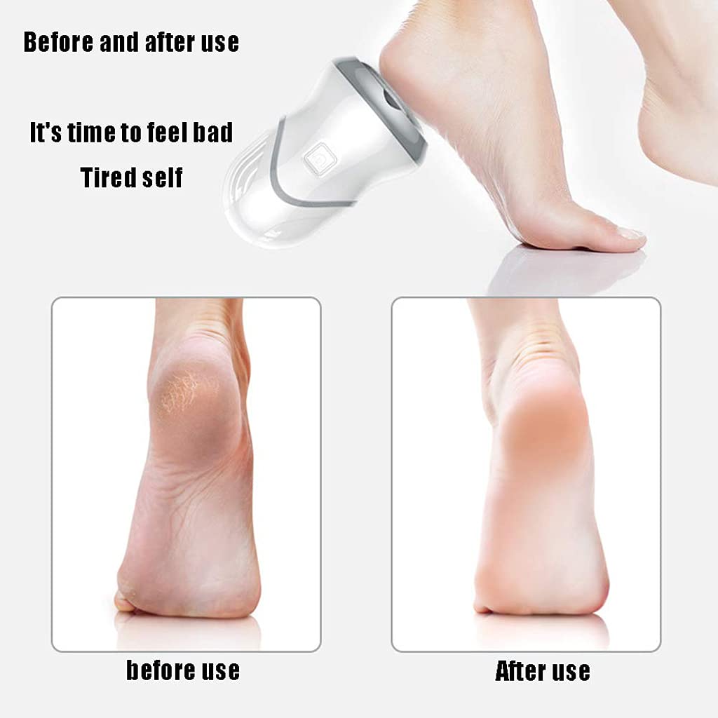 Amazon.co.jp: DXDUS 電動角質リムーバー usb充電式、真空吸引フット