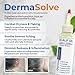 Dermasolve 4 oz Psoriasis, Seborrheic Dermatitis, & Dandruff Scalp Oil - Dermatologist Approved - Flaky Scalp Relief, Clinically Tested, Long-Lasting Itch-Free, High-Performance Formula