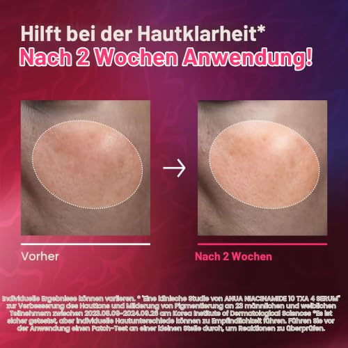 Anua Niacinamid 10% + Txa 4% Serum, Kpop Demon Hunters, 50ml – Ansicht 5