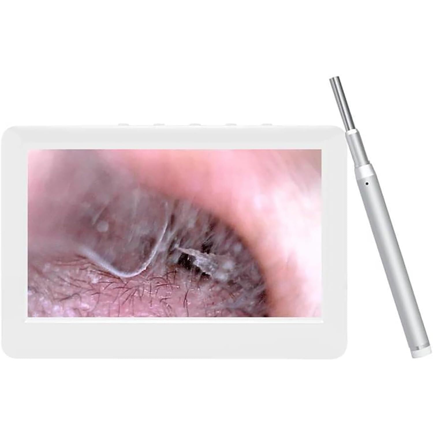 Otoscopio Digitale, Schermo IPS da 4,3" for rimozione cerume con 6 luci LED, Obiettivo da 3,9 mm, 5 milioni di Pixel, Supporta scatto foto e registrazione video, for la pulizia del condotto uditivo