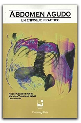 Abdomen Agudo. Un Enfoque Practico