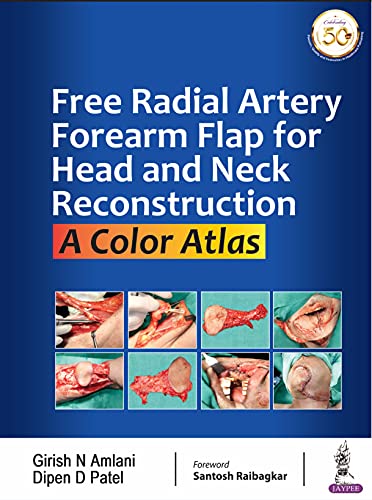 Free Radial Artery Forearm Flap For Head And Neck Reconstruction: A Color Atlas (English Edition)