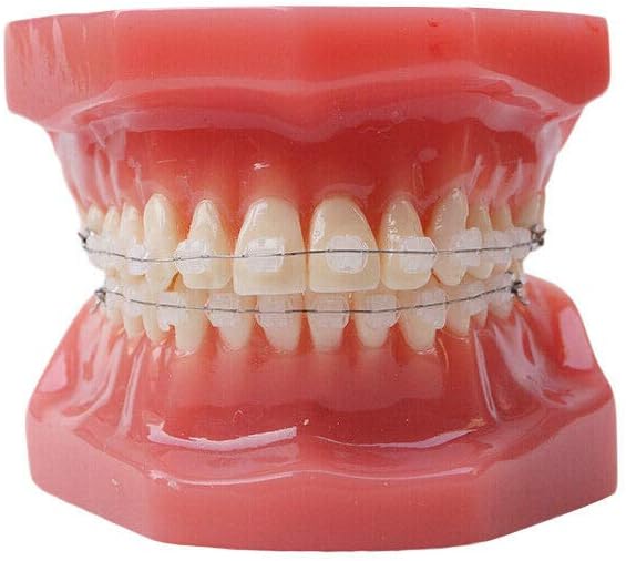 Dental Typodont With Ceramic Brackets Orthodontic Braces Teeth Model,28pcs Teeth Ceramic Braces Model For Teaching Practice