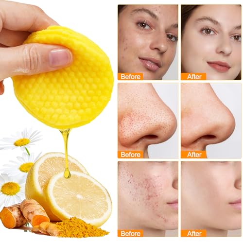 NIFEISHI Turmeric Kojic Acid Vitamin C Exfoliating Pads - 50 Count for Oil Control, Hydration & Dullness Reduction - Face & Body Cleansing Pads
