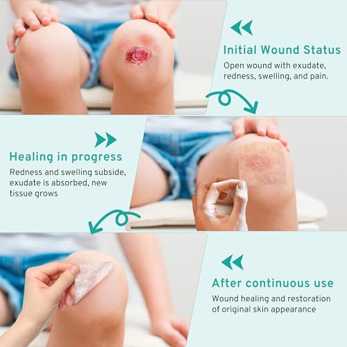 Hydrocolloid Roll for Wound Care Gentle Self-Adhesive 2in x 12ft — view 6