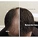 MEDIUM BROWN 50 GRAMS XL SIZE Original Samson Hair Loss Building Fibers Concealer Refill suitable match for all Brands 50 Gr MEDIUM BROWN