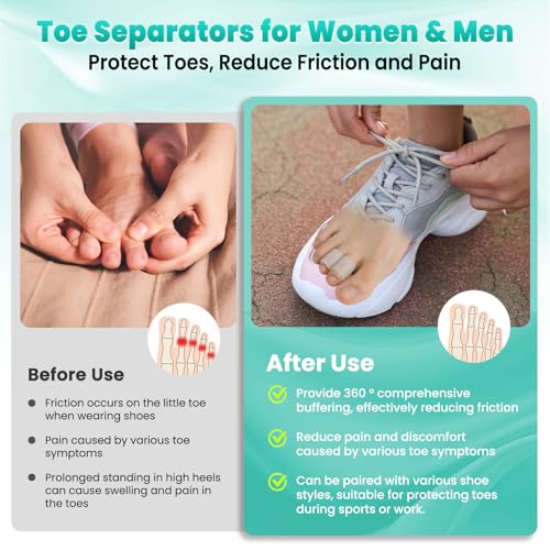 Image of Pnrskter Silicone Toe Protectors for Men & Women - 20 PCS Soft Toe Caps & Sleeves for Pinky Toe, Corns, Blisters, Calluses, Hammer Toes, Toe Cushions for All Day Comfortable & Friction Toe Relief