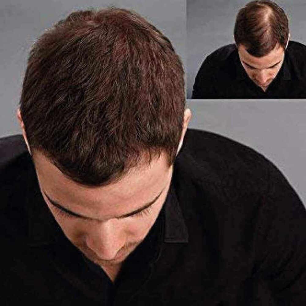 KÖ-HAIR FIBERS 30 g - Capelli sparsi in fibre di cotone per addensare i capelli, capelli naturali sfusi contro la caduta dei capelli, polvere per capelli più completa, nasconde le zone chiare al