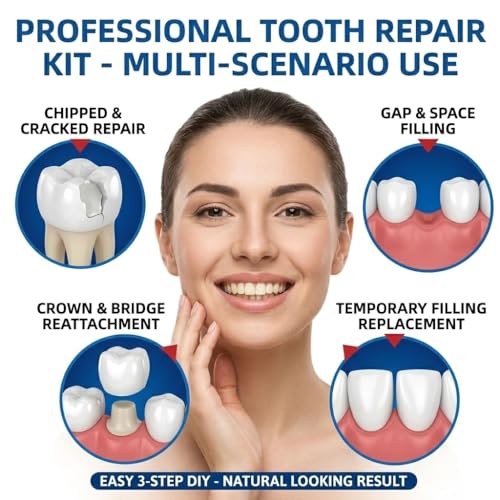 Image of Tooth Repair Kit Zinc Oxide Eugenol Cement Dental Care Kit, Temporary Teeth Replacement, Dental Care Repair for Broken Chipped Teeth, Crown Fillings & Bridges 2PCS