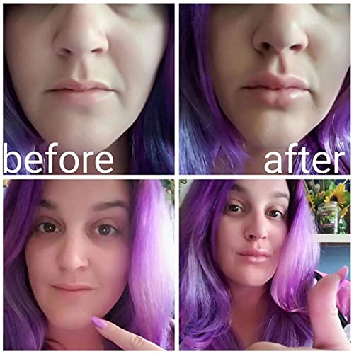 TAYSTE Lip Plumper-Gerät | Red Fish Shape Silikon-Lippenverstärker für Frauen | Lip Plumper für weibliche Schönheit, um die Lippen praller und Dicker zu Machen, Lippen-Make-up-Tool