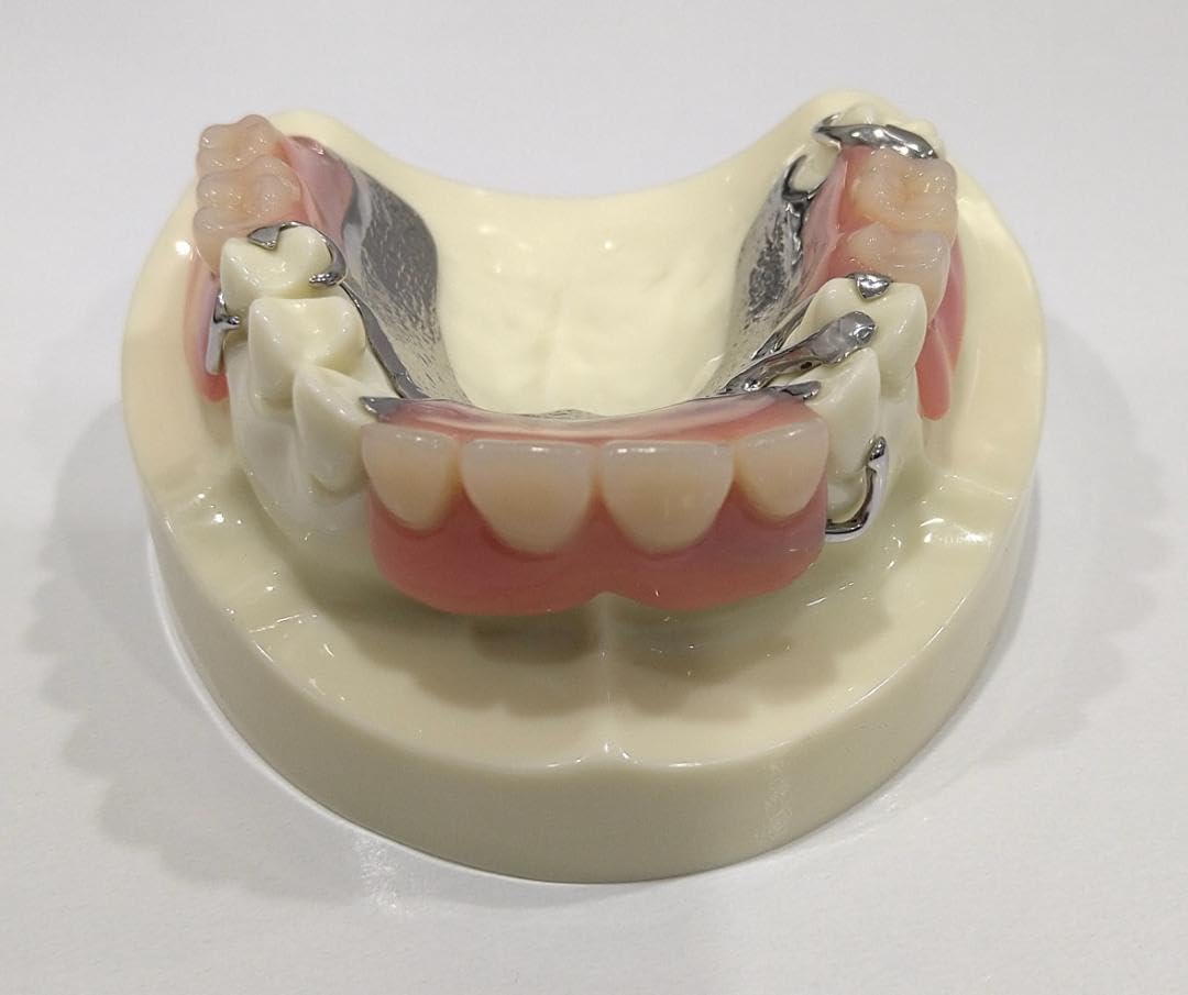 ○歯科用　部分床義歯ノンメタルクラスプ義歯デモ用模型 歯科 部分床義歯 デモ模型