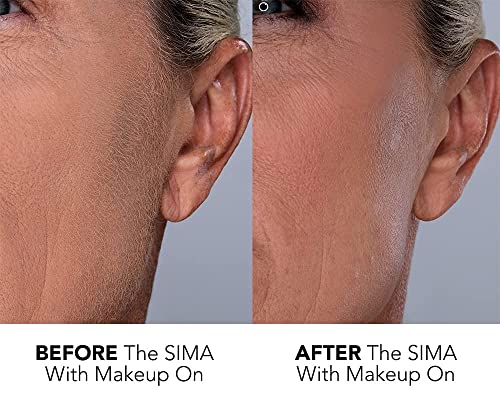 SPA-SCIENCES-SIMA-Dermaplaning-Tool-Patented-Painless-2-in-1-Facial-Exfoliation-Peach-Fuzz-Hair-Removal-System-w-7-Weeks-Treatment-Included-Anti-Aging--3-Speeds-Rechargeable