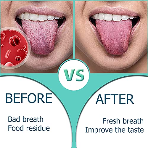 Tongue Scraper,Medical Grade Tounge Scraper Cleaner,Stainless Steel 100% Bpa Free Metal Tongue Scrapers,Fights Bad Breath,Great For Oral Hygiene,Tongue Cleaners For Adults And Kids(Pack Of 2) #TOP1