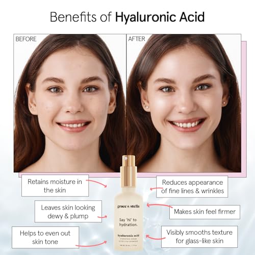 Image of grace & stella Award Winning Hyaluronic Acid Face Serum (50ml /1.7 fl oz) Removes Fine Lines & Wrinkles, Hydrating Hyaluronic Acid Serum for Face, Acido Hialuronico for Women - Vegan Skincare (2-Pack)