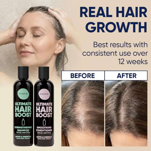 Image of Moerie Hair Growth Shampoo and Conditioner for Women and Men, Hair Loss Solution with Biotin and Rosemary, Thickening Shampoo and Conditioner for Thinning Hair - Promotes Regrowth, Double Set