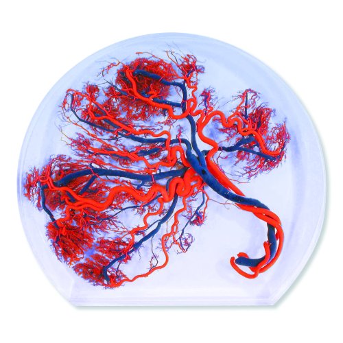 Image of 3B Scientific W10604 Placenta, Obstetrics /Gynecology Model, 8.3 inch x 6.7 inch x 1.6 inch