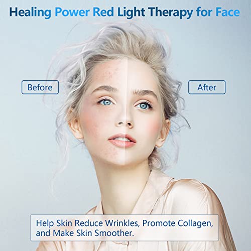 IKeener Torcia per Terapia a Luce