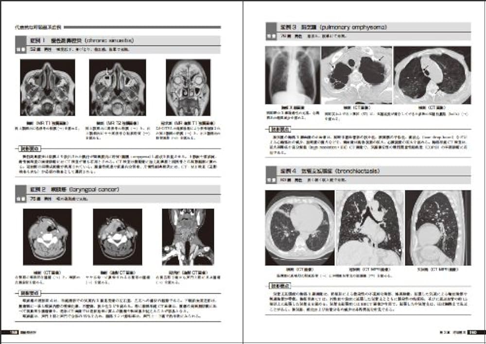 画像解剖学 (診療画像検査法) | 金森 勇雄, 藤野 明俊, 丹羽
