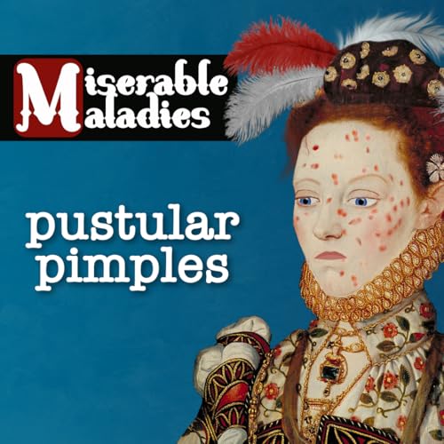 Tudor Time Machines's Miserable Maladies: Pimples