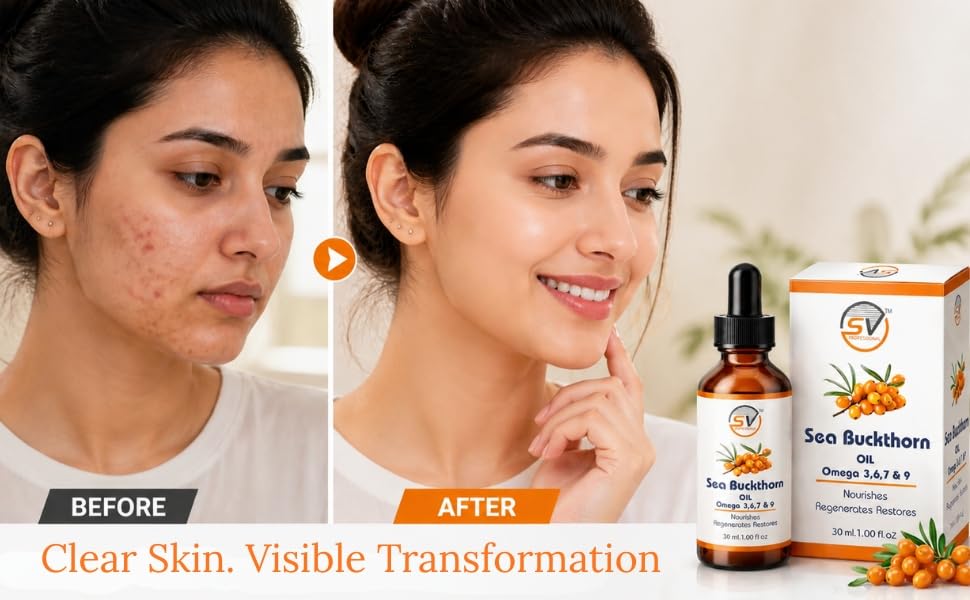 Image of Sea Buckthorn Oil 30ml Face Serum & Face & Hair | Nourishing Oil with Omega 3,6,7 & 9 | Collagen Boosting | Reduces Fine Lines, Dark Spots & Dull Skin | For Smooth & Glowing Skin (Pack of 1 Each)