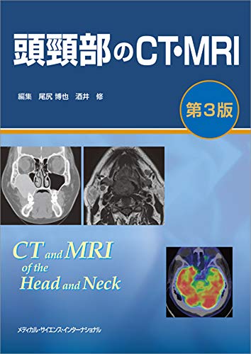 オライリー 無料電子書籍 頭頸部のCT・MRI 第3版 バイ