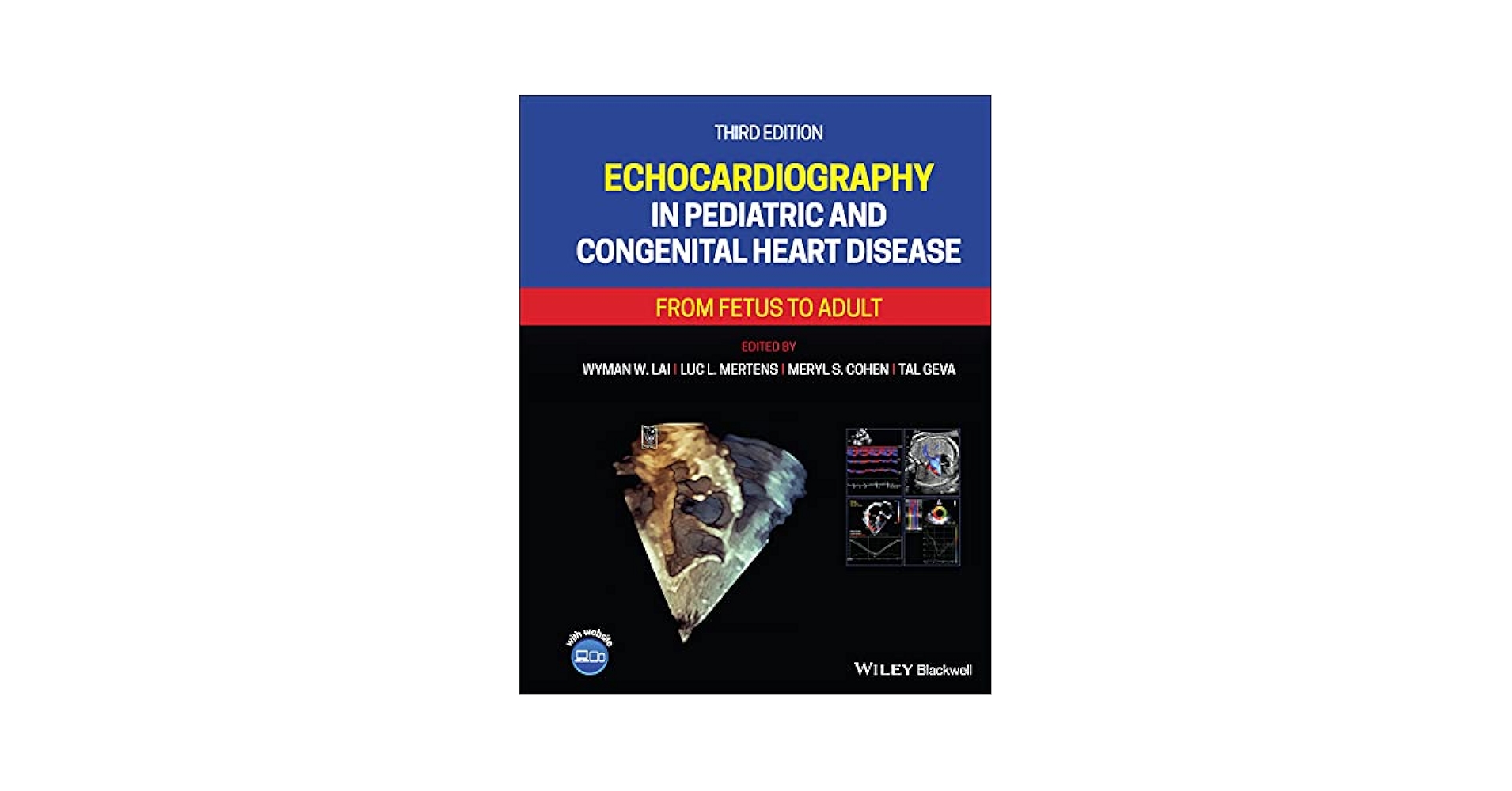 洋書 Echocardiography in Congenital Heart Dis Echocardiography in Congenital Heart Disease: Expert Consult