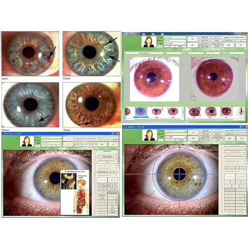 Cámara de iridología portátil y detector de iris de 5.0 MP para centros de salud 6