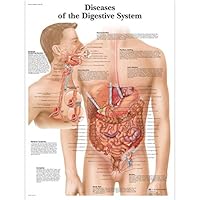3B Scientific Lehrtaffel - Diseases Digestive System - Englisch