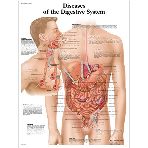 3B Scientific Lehrtaffel - Diseases Digestive System - Englisch