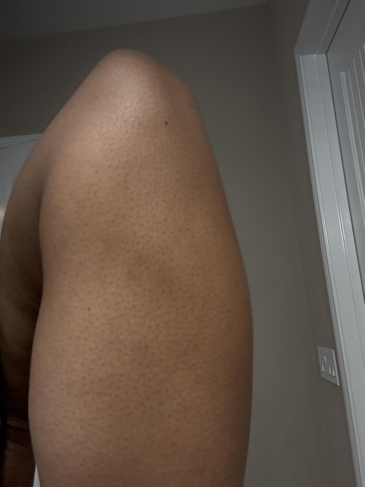 Customer bruise cream review
